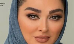 عکس های باورنکردنی از خانم بازیگران ایرانی بعد از عمل زیبایی / زشت تر از قبل شدند !