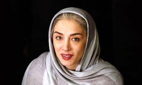 عکس های شوکه کننده از 5 خانم بازیگر سرشناس ایرانی / دیگر زیبا نیستند !