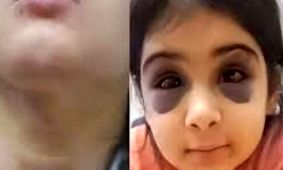 کودک ۹ ساله در سنندج قربانی خشونت نامادری / پدر همسر باردار را از خانه بیرون کرد، دخترش را نزد خود نگه داشت + جزییات