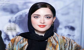 تازه ترین عکس از چهره بهنوش طباطبایی / بعد از عمل واقعا زیبا شد !