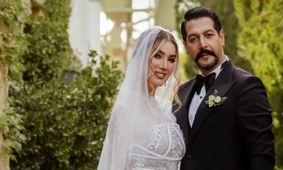 عکس لو رفته متین ستوده قبل از عمل‌های زیبایی!