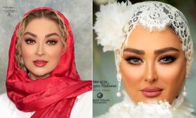 عکس باورنکردنی از صورت خونی الهام حمیدی / چهره پر از عمل و آرایش به چه روزی افتاد!