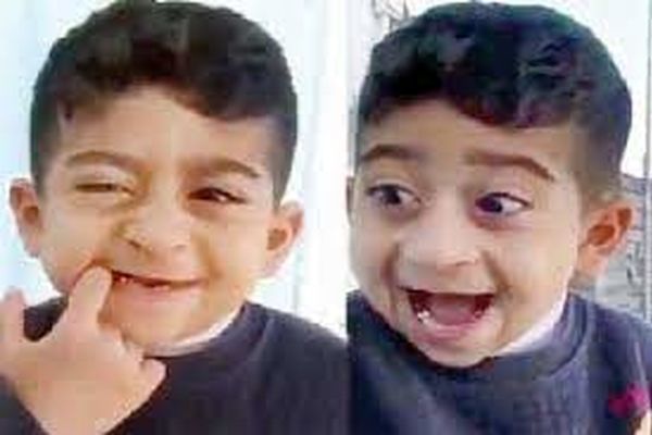 چهره باورنکردنی امیرعباس کچلیک در نوجوانی! +فیلم