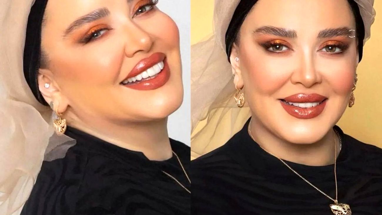 عکس جنجالی از تغییر چهره بهاره رهنما با جدیدترین عمل زیبایی