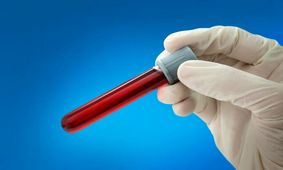 توسعه آزمایش خون جدیدی که می‌تواند 14 نوع سرطان را قبل از گسترش تشخیص دهد
