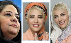 تغییر چهره رابعه اسکویی بعد از لاغری جنجالی / باربی ایران مدل هالیوودی شد !