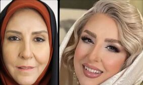 تغییر چهره حاشیه ساز مرجانه گلچین در این سن و سال / چرا تن به این کار داد ؟!