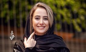 تغییر چهره شوکه کننده الناز حبیبی بعد از عمل زیبایی / جاسوئیچی واقعا جذاب شد !