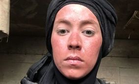 تصاویر شوکه‌کننده از تغییر چهره نیلوفر رجایی‌فر بعد از سریال پایتخت!