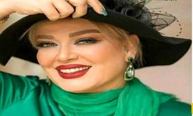 مقایسه چهره امروز و 20 سال گذشته سلبریتی های ایرانی / از بهاره رهنما تا الهام چرخنده !