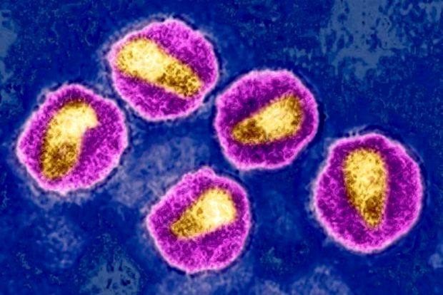واکسن جدید HIV
