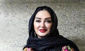 عکس های خیره کننده از الهام حمیدی بعد عمل های زیبایی