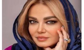 عکس خیلی زننده از چهره بهاره رهنما بعد تزریق زیبایی ! / زامبی و ترسناک !