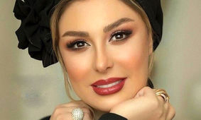  افشاگری جنجالی نیوشا صیغمی از عمل های زیباییش / مجبور شدم + فیلم 