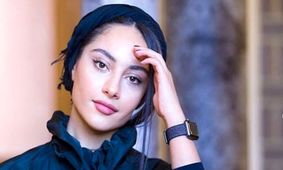 نگاه‌ها به ترلان پروانه: تغییر چهره‌ای که همه را حیرت‌زده کرد!