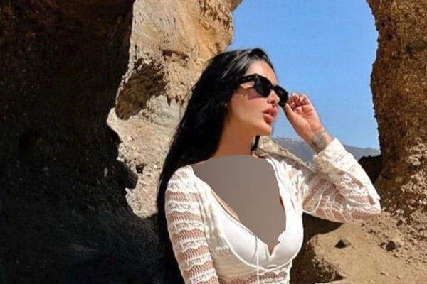 تغییر چهره هوش پران دنیا جهانبخت بعد از جراحی های زیبایی / ما فقط پول نداریم وگرنه زشت نیستیم !
