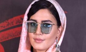 عکس شوکه کننده از الناز شاکردوست در 19 سالگی / بدون عمل با ابروی نازک !