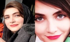 جذابیت خیره کننده الناز ملک در سریال زخم کاری / زیبایی که در سقوط پنهان شد !
