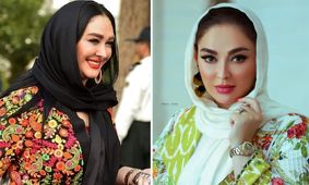 فیلم شوکه کننده از الهام حمیدی بعد از عمل های زیبایی / خانم بازیگر را نمی شناسید !