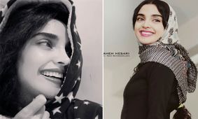 عکس های باورنکردنی از الهه حصاری قبل از عمل بینی ! / چی بود چی شد !