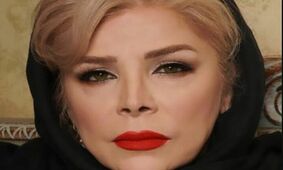 تغییر چهره شیوا خنیاگر با تزریق ژل و بوتاکس / 20 سال جوان شد !