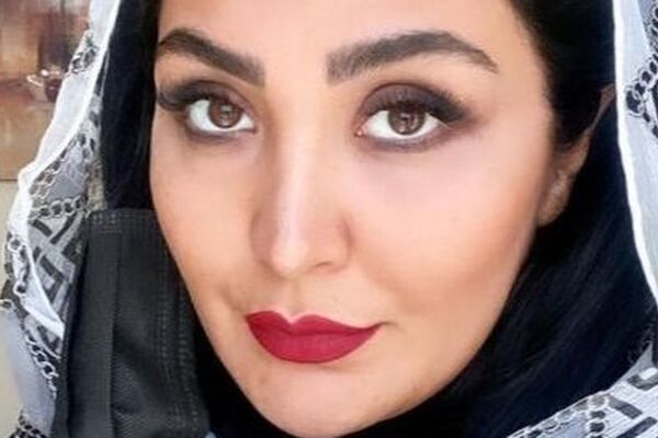 تغییر باورنکردنی در چهره مریم معصومی؛ باور می‌کنید این بازیگر کیست؟